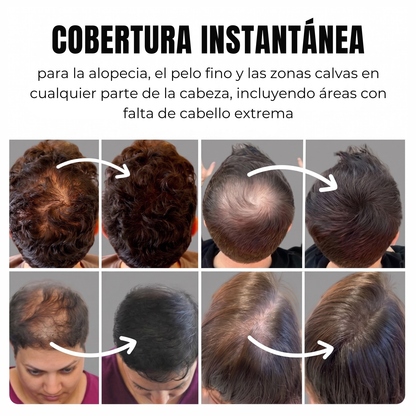 Comfy® 2.0 Rellenador Capilar Premium